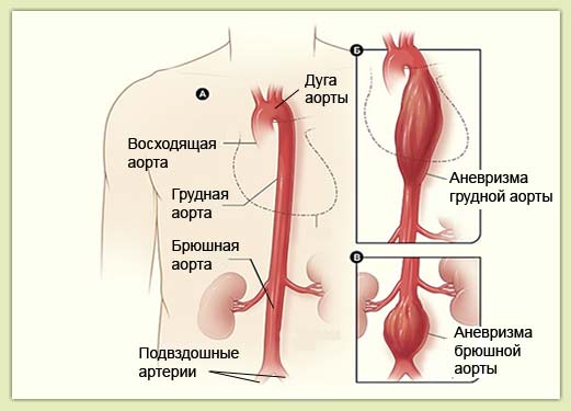 морфологический разбор слова аорта