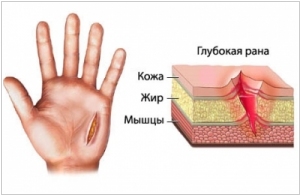 морфологический разбор слова ссадина